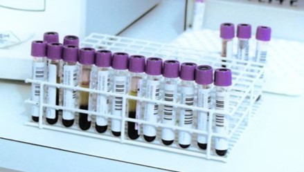 진단업체 현금 곳간 3년새 70% 급감...코로나 특수 여력 고갈 - 뉴스 썸네일 이미지