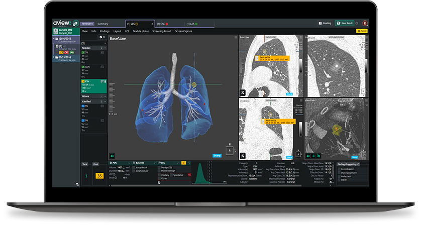 코어라인소프트 AVIEW LCS, 산업부 혁신제품 지정