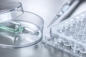 혈액제제, 내수 감소에도 수출 50%↑...'알리글로 효과'