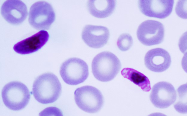 한국로슈진단, 헌혈 혈액 말라리아 선별 검사 시약 출시