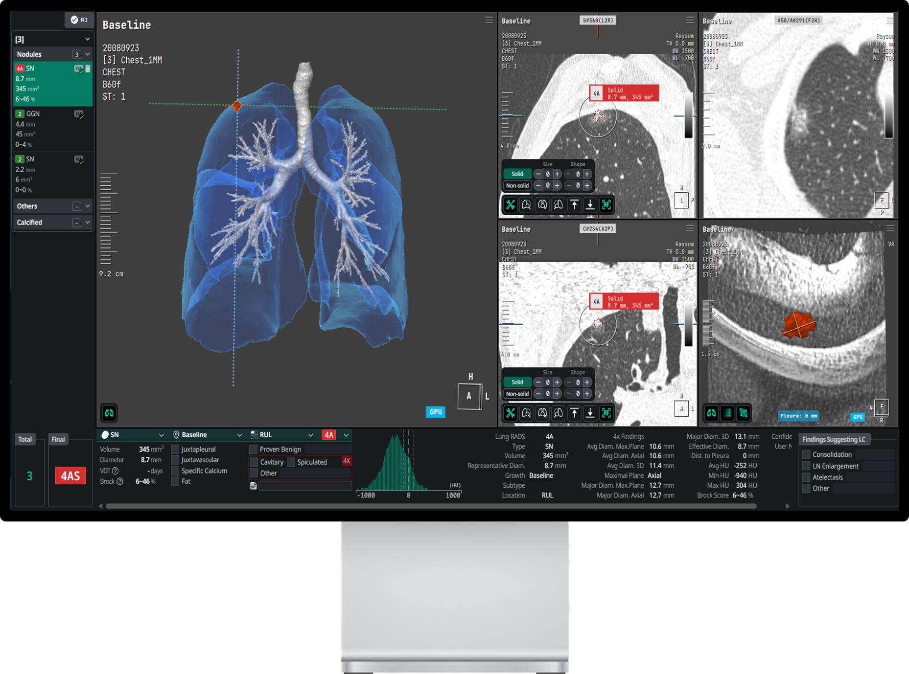 코어라인소프트, 호주 NLCSP 레퍼런스 확대…AI 입지 강화